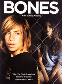 Bones